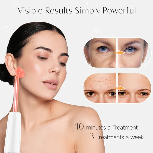 Wrinkles Remover Beauty Facial Care - Image 5